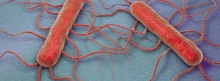 Weltweiter Rückruf: 2 Todesfälle durch Listeria monocytogenes in Wurstwaren