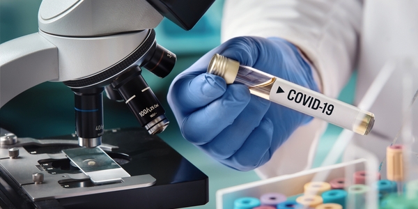 COVID-I9: Ministerium will mehr Tests COVID-I9: Ministerium will mehr Tests