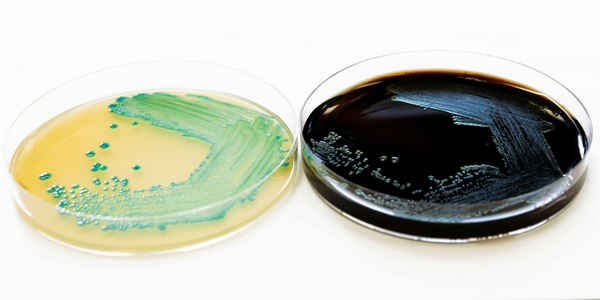 Listeria monocytogenes in 6h: schnellste Ergebnisse zur Ursachenfindung haben in Krisenfällen höchste Priorität Listeria monocytogenes in 6h: schnellste Ergebnisse zur Ursachenfindung haben in Krisenfällen höchste Priorität