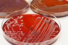 Keimidentifizierung in wenigen Minuten mit MALDI-TOF Keimidentifizierung in wenigen Minuten mit MALDI-TOF