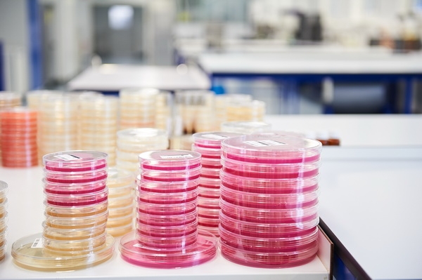 Schnelle und zuverlässige Untersuchungen auf Listeria spp., Listeria monocytogenes, Salmonellen & Co.