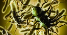 Erneuter Rückruf aufgrund von Listeria monocytogenes in Fleischerzeugnissen Erneuter Rückruf aufgrund von Listeria monocytogenes in Fleischerzeugnissen