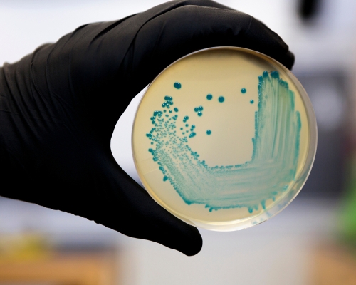 Tenta Speed L. mono - A new rapid testing method for Listeria spp. and Listeria monocytogenes in food with detection in six hours! 