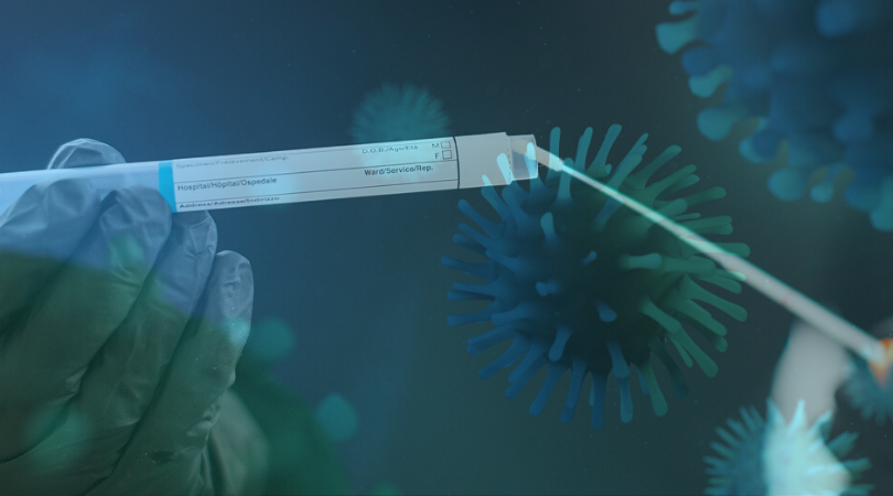 SARS-CoV-2 Untersuchungen auf Oberflächen, Bedarfsgegenständen und Medizinprodukten SARS-CoV-2 Untersuchungen auf Oberflächen, Bedarfsgegenständen und Medizinprodukten