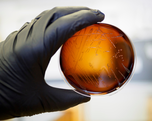 Schnellmethode zum Nachweis von Listeria spp. und Listeria monocytogenes.