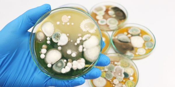 Neue Schnellmethode zur Bestimmung von Hefen und Schimmelpilzen in Kosmetika in nur 3 Tagen Neue Schnellmethode zur Bestimmung von Hefen und Schimmelpilzen in Kosmetika in nur 3 Tagen