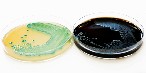 Schnell und zuverlässig Listeria monocytogenes in Lebensmitteln nachweisen