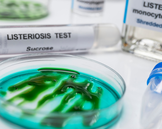 Warum sind Challengetests mit Listeria monocytogenes erforderlich? Warum sind Challengetests mit Listeria monocytogenes erforderlich?