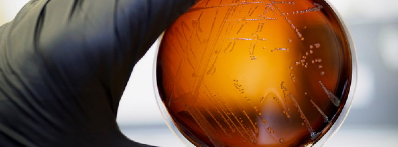 Belastungstests bzw. Challengetests mit Listeria monocytogenes in Lebensmitteln Belastungstests bzw. Challengetests mit Listeria monocytogenes in Lebensmitteln