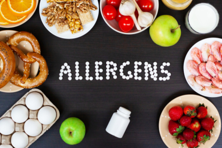 Allergene in Lebensmitteln –Bilanz 2020 der CVUAs Baden-Württembergs Allergene in Lebensmitteln –Bilanz 2020 der CVUAs Baden-Württembergs