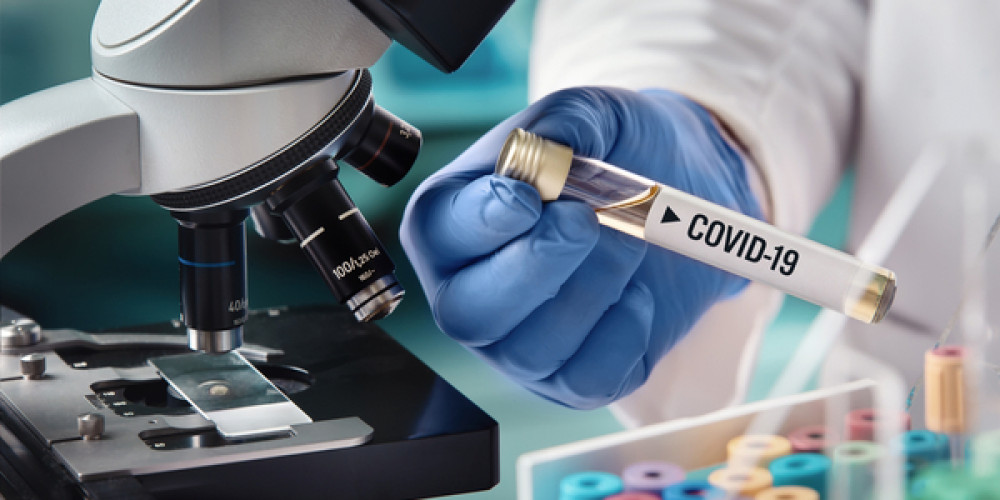 COVID-I9: Ministerium will mehr Tests COVID-I9: Ministerium will mehr Tests