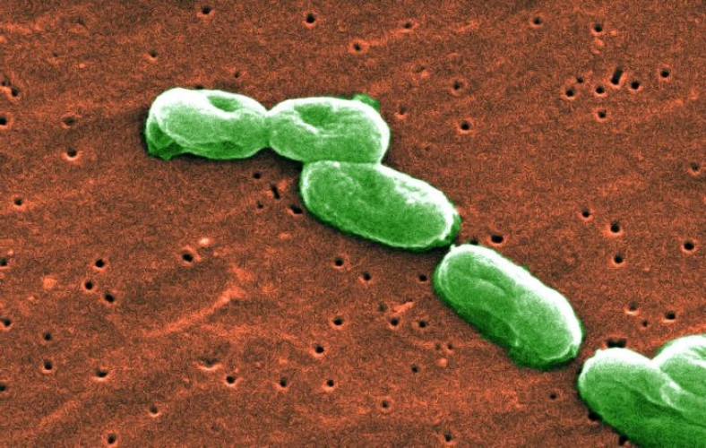 Keim Burkholderia cepacia in Kosmetik kann zur Gesundheitsgefahr werden Keim Burkholderia cepacia in Kosmetik kann zur Gesundheitsgefahr werden