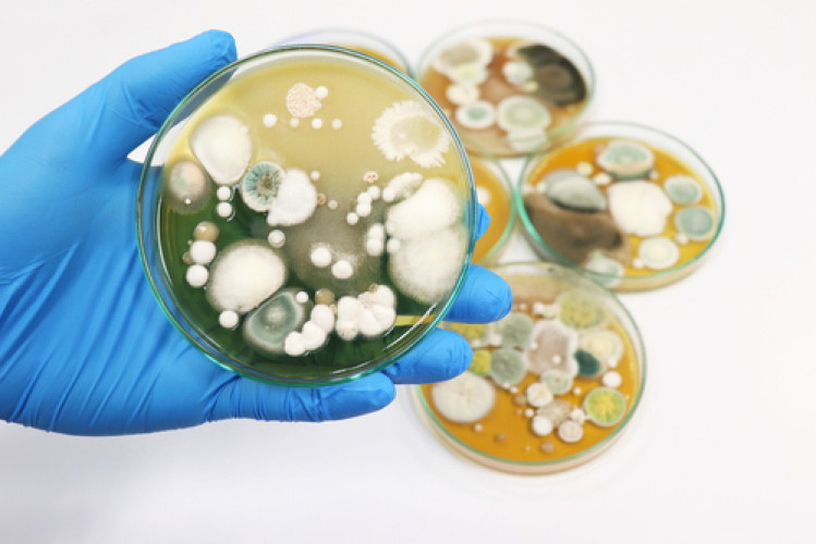 Yeasts and molds in food – express testing also available Yeasts and molds in food – express testing also available