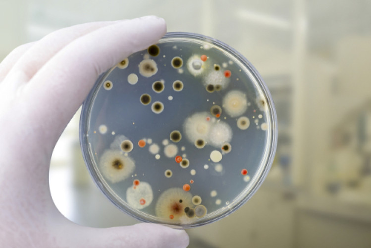 Schnellmethode zur Bestimmung von Hefen und Schimmelpilzen in Kosmetika in nur 3 Tagen Schnellmethode zur Bestimmung von Hefen und Schimmelpilzen in Kosmetika in nur 3 Tagen