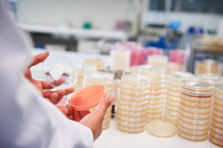 Pseudomonas aeruginosa – ein gefährlicher Keim Pseudomonas aeruginosa – ein gefährlicher Keim