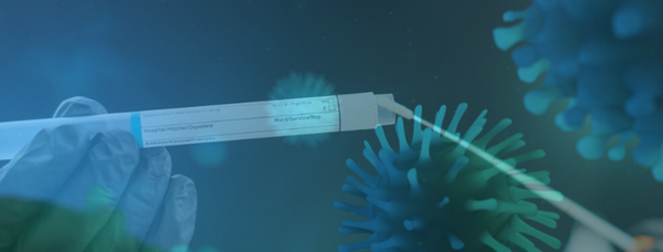 Oberflächentests auf Coronavirus SARS-CoV-2 geben wichtige Informationen Oberflächentests auf Coronavirus SARS-CoV-2 geben wichtige Informationen