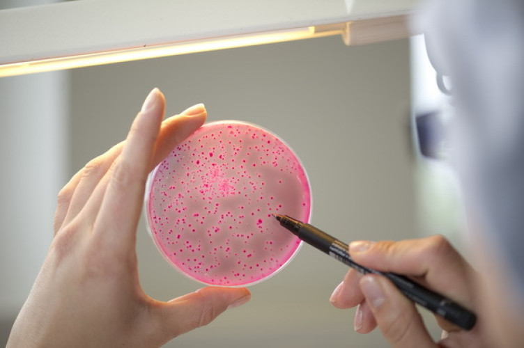 DGK Expert Panel: Ask our Microbiology Experts DGK Expert Panel: Ask our Microbiology Experts