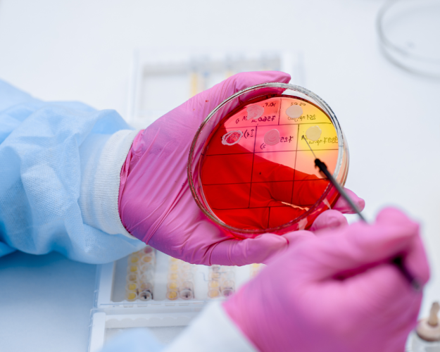 Mikrobiologische Verunreinigungen kosmetischer Mittel Mikrobiologische Verunreinigungen kosmetischer Mittel