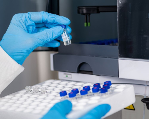 BfR veröffentlicht Informationen zu 3-MCPD, 2-MCPD und Glycidyl-Fettsäureestern BfR veröffentlicht Informationen zu 3-MCPD, 2-MCPD und Glycidyl-Fettsäureestern