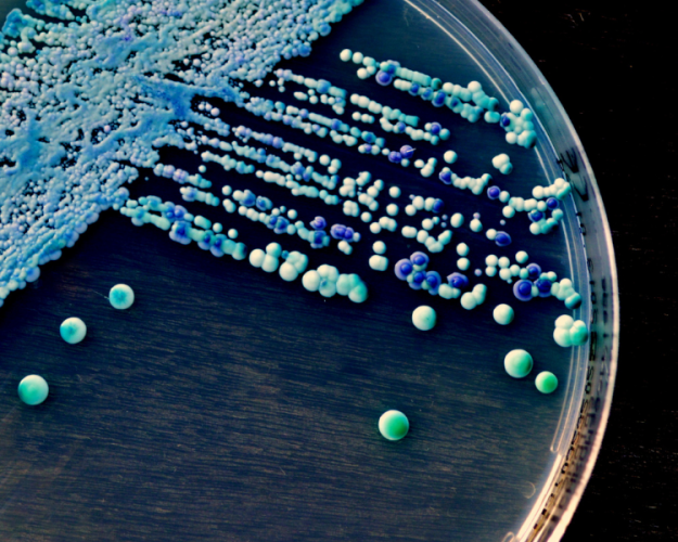New rapid method: Detection of osmotolerant and/or osmophilic yeasts in just six days New rapid method: Detection of osmotolerant and/or osmophilic yeasts in just six days