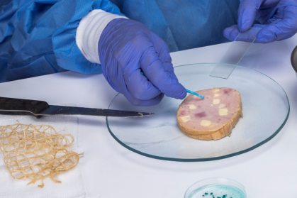 Aktuelle Rückrufe aufgrund von Listerien Aktuelle Rückrufe aufgrund von Listerien