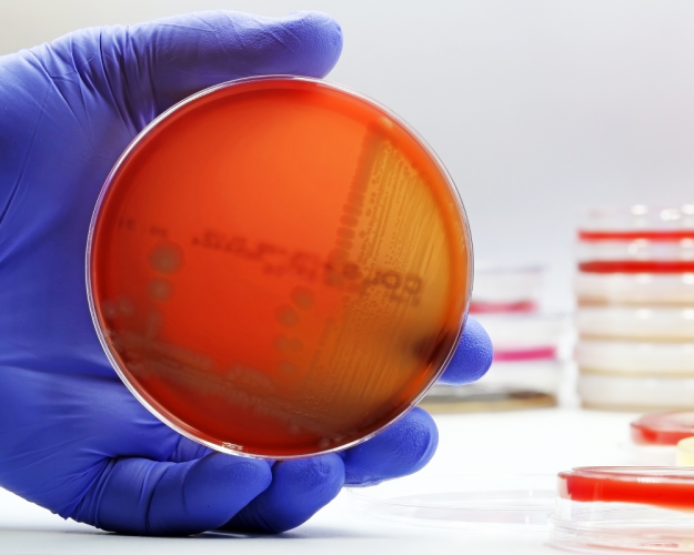 Current recall: STEC/VTEC in beef sausages Current recall: STEC/VTEC in beef sausages