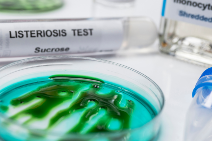 Warum sind Challengetests mit Listeria monocytogenes erforderlich? Warum sind Challengetests mit Listeria monocytogenes erforderlich?