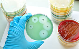 Mikrobiologie